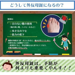 縁の下のおやすみ外反サポーター 就寝中 しっか...の詳細画像3