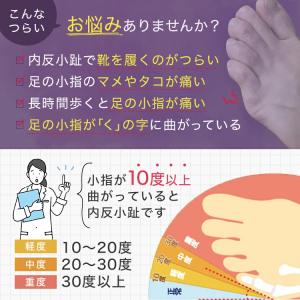 内反小趾 サポーター 矯正 小趾サポーター な...の詳細画像1