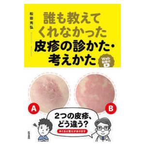 誰も教えてくれなかった皮疹の診かた・考えかた［Web動画付］