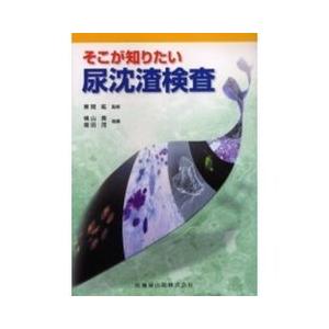 そこが知りたい尿沈渣検査