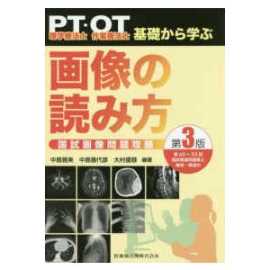 理学療法士・作業療法士ＰＴ・ＯＴ基礎から学ぶ画像の読み方国試画像問題攻略 第３版