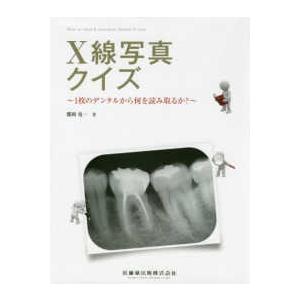 Ｘ線写真クイズ-１枚のデンタルから何を読み取るか？