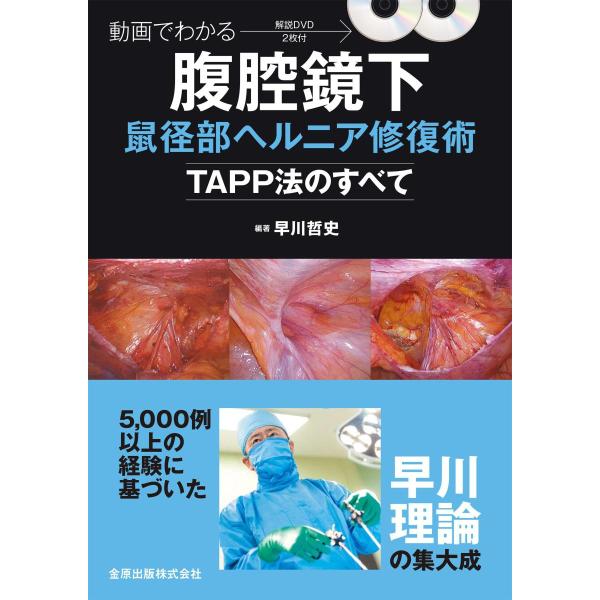 動画でわかる腹腔鏡下鼠径部ヘルニア修復術−ＴＡＰＰ法のすべて−
