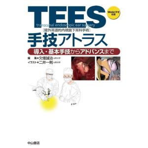 ＴＥＥＳ(経外耳道的内視鏡下耳科手術)手技アトラス-導入・基本手技からアドバンス