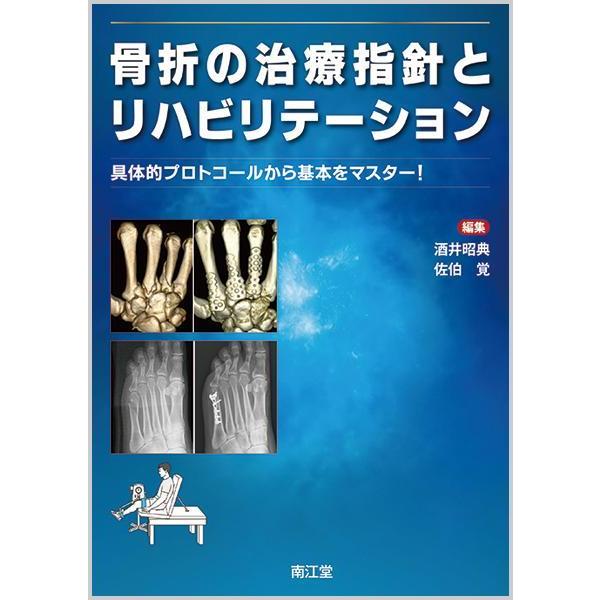 骨折の治療指針とリハビリテーション-具体的プロトコールから基本をマスター!