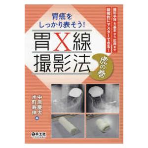 胃癌をしっかり表そう!胃Ｘ線撮影法虎の巻-撮影手技を基本から応用まで段階的にマス