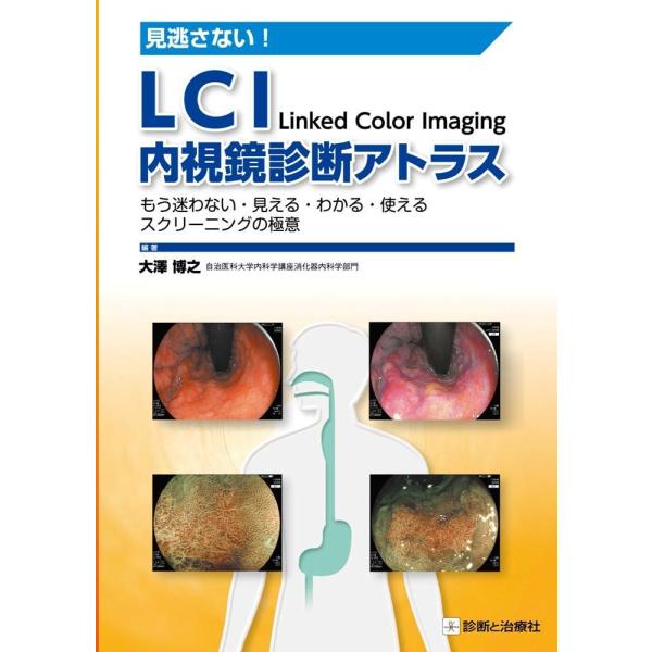 見逃さない!LCI内視鏡診断アトラス-もう迷わない・見える・わかる・使えるスクリ