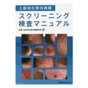 上部消化管内視鏡スクリー二ング検査マニュアル