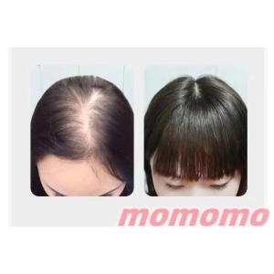 ウィッグ ヘアピース 部分ウィッグ 人毛100...の詳細画像1