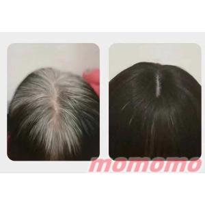 ウィッグ ヘアピース 部分ウィッグ 人毛100...の詳細画像2