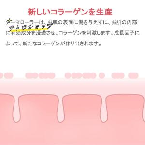 美顔器 ダーマペン 電動ダーマスタンプ 最新充...の詳細画像2