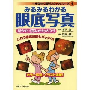 みるみるわかる眼底写真見かた・読みかたのコツ (一歩先ゆく眼科スタッフシリーズ 1) 古本 古書