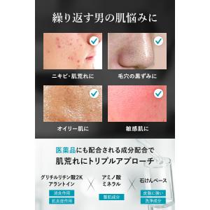洗顔 メンズ [ 毛穴 黒ずみ 角栓 テカリ ...の詳細画像2