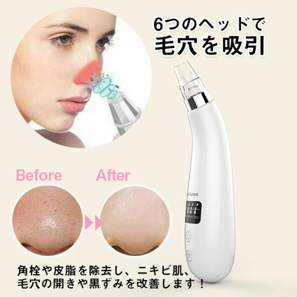 毛穴吸引器 毛穴クリーナー 美顔器 フェイスケア ピーリング Ems リフトアップ 毛穴 ケア しわ取り ニキビ吸引 角質 角栓 黒ずみ改善 毛穴 吸引x 601 Wh 一撃shop 通販 Paypayモール
