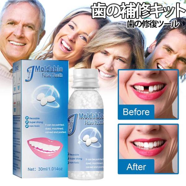 歯の修復ツール 成形可能 歯の補修キット 変装 差し歯 入れ歯 仮歯 固形接着剤 一時的 義歯 歯の欠け 材料 歯の補修キット 応急処置 セルフ 義歯