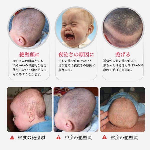 ベビー枕 赤ちゃん 新生児 まくら 絶壁 寝返り防止 寝ハゲ対策 快眠 丸洗い 男女兼用 0月 3歳の新生児対応 A 161 Worldwind 通販 Yahoo ショッピング