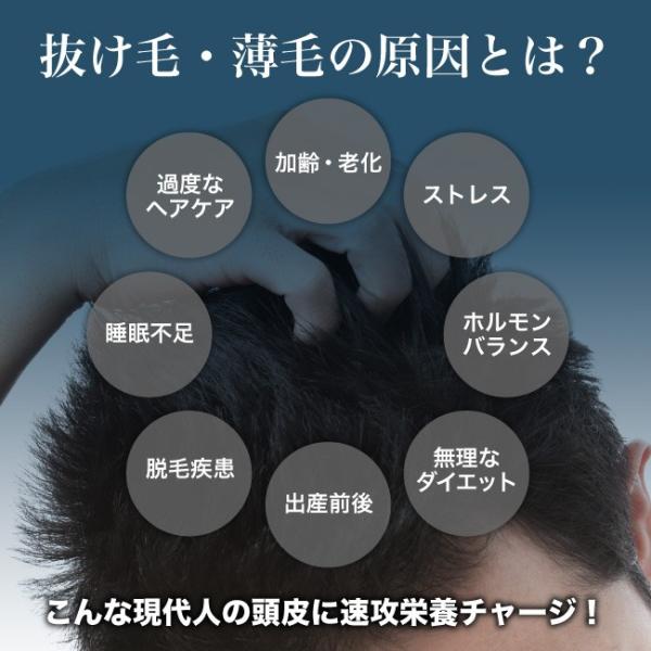 抜け毛、薄毛の原因とは？加齢、老化、ストレス、過度なヘアケア、睡眠不足、寝不足、ホルモンバランス、脱毛疾患、脱毛症、円形脱毛症、出産、ダイエット、食生活、食事制限、薄毛、AGA、悩み解決