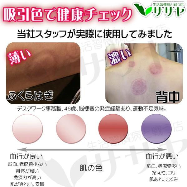 カッピング 吸い玉 吸玉 M 1個 中サイズ シリコン製カッピング 肩こり 解消 マッサージ ツボ押し 生活習慣病と戦う店ササヤ Amc メール便 Yys 鍼灸 Buyee Servis Zakupok Tretim Licom Buyee Pokupajte Iz Yaponii