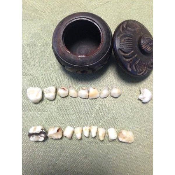 抜けた乳歯を記念品に 乳歯ケース保存よりもきれいに保存 乳歯 乳歯模型 ベビーキッズ 記念品 Buyee Buyee 日本の通販商品 オークションの代理入札 代理購入