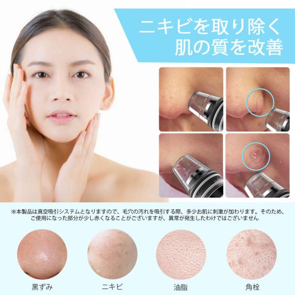 Anlan毛穴吸引器 毛穴ケア吸引器 Lcdディスプレイ搭載 毛穴ケア美顔器 40 温熱ケア ニキビ吸引 黒ずみ取り イチゴ鼻 汚れ 角栓除去 3種類ヘッド 3段階吸引力 Buyee Buyee Japanese Proxy Service Buy From Japan Bot Online