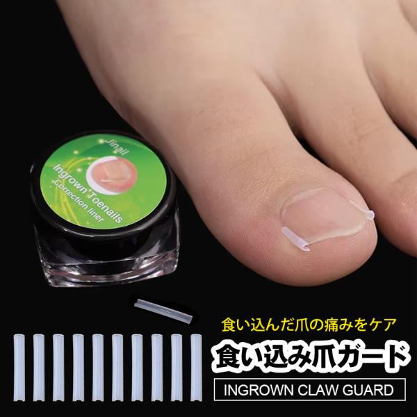 ◆商品名巻き爪ガード まきづめ 巻き爪 痛み 巻き爪食い込み 陥入爪 まき爪 まきづめ 巻爪くい 爪食い込み 痛い 陥入爪◆特徴とても痛い場合はもちろん、軽度の巻き爪で たまに痛む、ちょっと傷みを感じる、などで悩んでいませんか？Cスロット設...