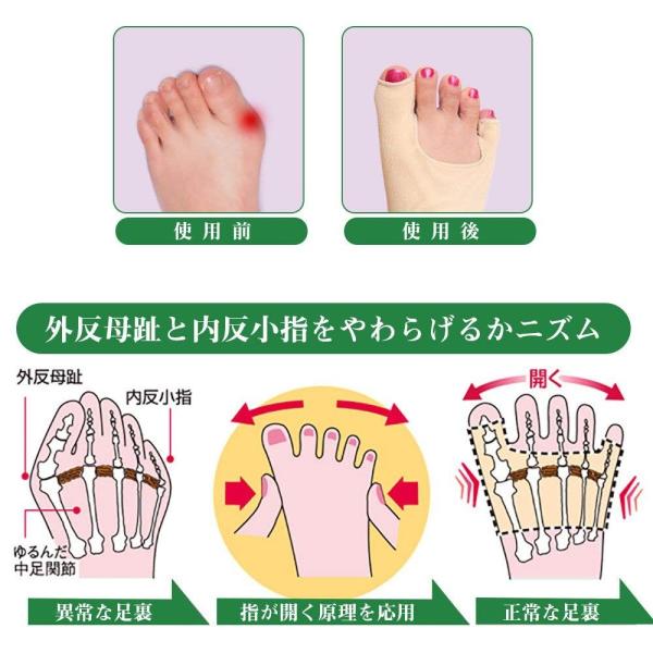 外反母趾 内反小趾 サポーター シルク 外反母趾 小指サポーター 矯正 薄手 抗菌 防臭 蒸れない 足指広げる 親指 小指 曲がり 対策グッズ美脚 姿勢改善 Buyee Buyee Japanese Proxy Service Buy From Japan Bot Online