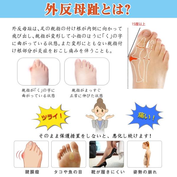 外反母趾 サポーター 指間パッド 足裏保護 医療用 柔らかい シリコンパッド 外反母趾グッズ フットケア 足指広げ セパレーター 足指パッド 刺激 浮き指 矯正 Buyee Buyee 提供一站式最全面最專業現地yahoo Japan拍賣代bid代拍代購服務 Bot Online