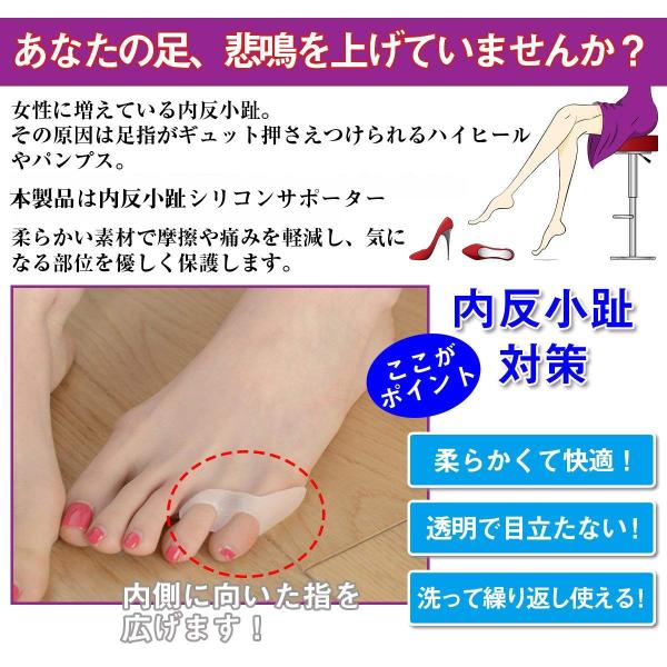 2足4個セット 内反小趾 矯正パッド 靴ズレ防止 小指ジェルパッド 内反小趾グッズ 予防矯正 足指広げケア セパレーター 小指痛み フットケア 送料無料 Buyee Buyee 日本の通販商品 オークションの代理入札 代理購入
