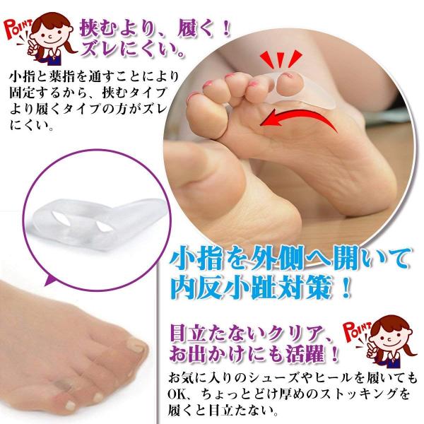 2足4個セット 内反小趾 矯正パッド 靴ズレ防止 小指ジェルパッド 内反小趾グッズ 予防矯正 足指広げケア セパレーター 小指痛み フットケア 送料無料 Buyee Buyee Japanese Proxy Service Buy From Japan Bot Online