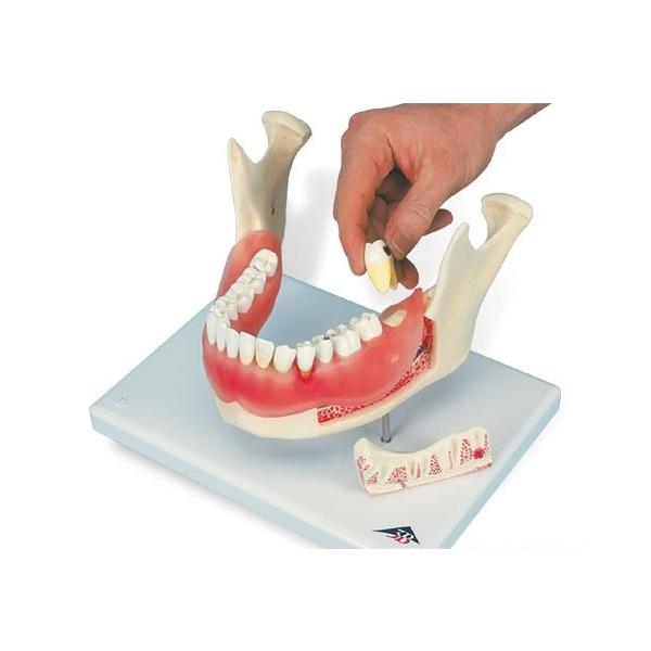 Nk Ώېi 3B  l̖͌^ @Eo͌^ Ǝs̎f (d26) @ I  ͌^