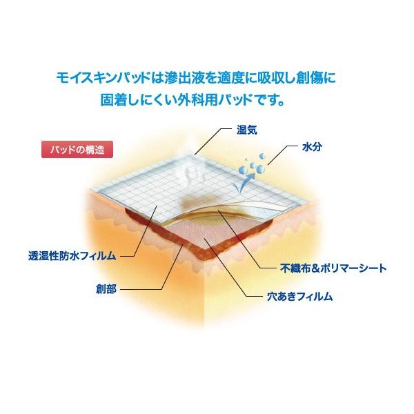 白十字 モイスキンパッド Mini 滅菌済 30袋入 : Shop de Clinic - 通販