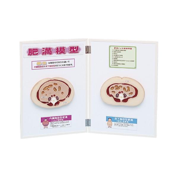 얞͌^ib^E牺b^j    KF-1607