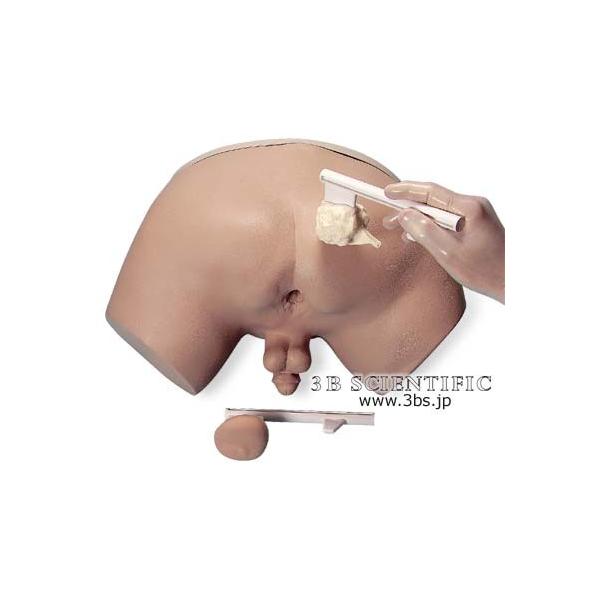 NkΏېi E 3BTCGtBeBbN  ͌^ OBV~[^[ I  ͌^