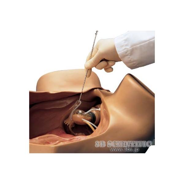 NkΏېi E 3BTCGtBeBbN  ͌^ wlȐf@V~[^[AoΉ^ I  ͌^