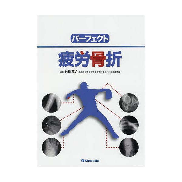 パーフェクト疲労骨折/石橋恭之