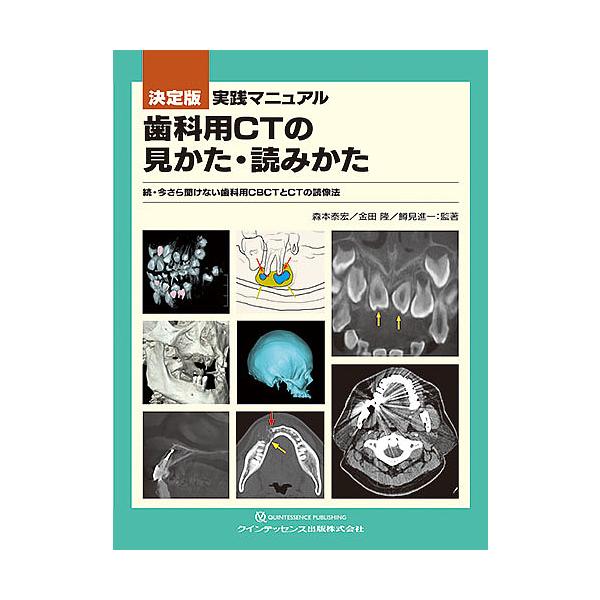 実践マニュアル歯科用CTの見かた・読みかた 決定版 今さら聞けない歯科用CBCTとCTの読像法 続/森本泰宏/著金田隆/著鱒見進一