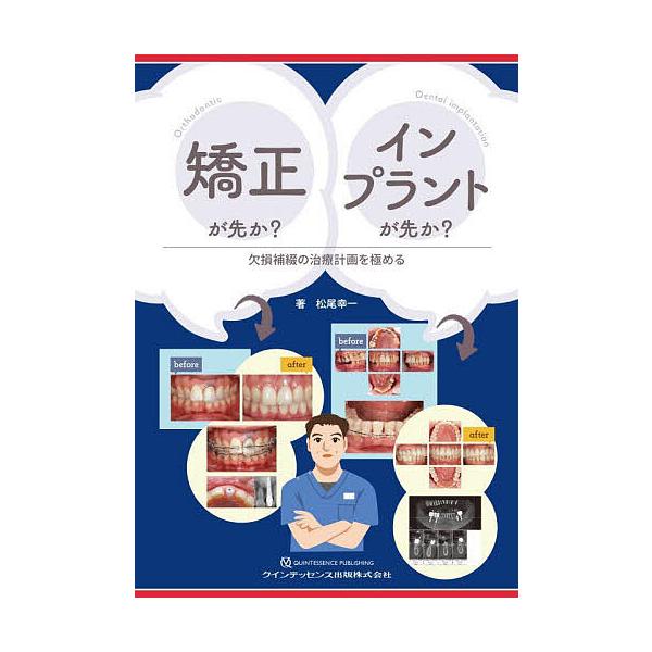 【裁断済み】矯正が先か？インプラントが先か？　欠損補綴の治療計画を極める 矯正が先かインプラントが先か 欠損補綴の治療計画を極める/松尾幸一