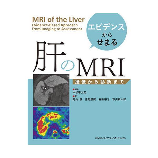 エビデンスからせまる肝のMRI 撮像から診断まで/本杉宇太郎/舟山慧/佐野勝廣