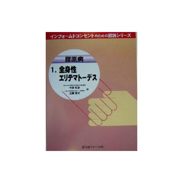 膠原病(1) 全身性エリテマトーデス インフォームドコンセントのための図説シリーズ膠原病1/竹原和彦(