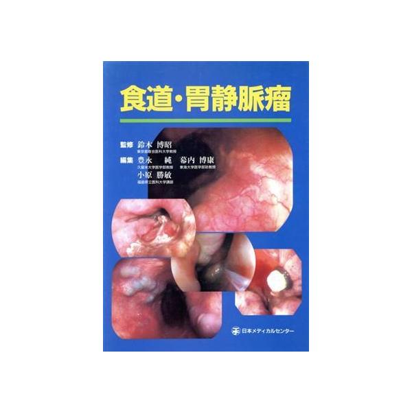食道・胃静脈瘤/鈴木博昭(著者)