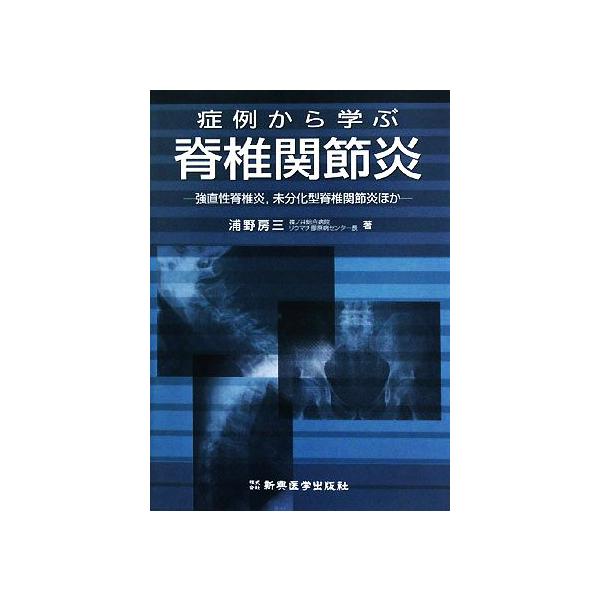 症例から学ぶ脊椎関節炎 強直性脊椎炎、未分化型脊椎関節炎ほか/浦野房三【著】
