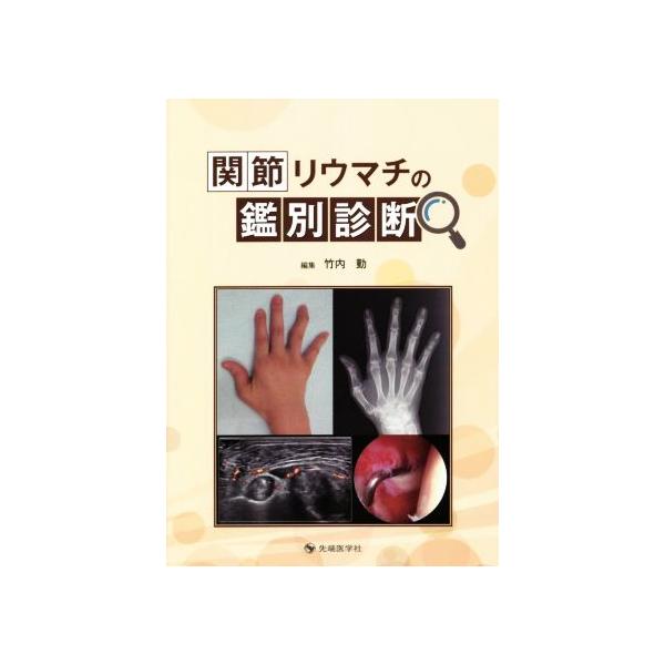 関節リウマチの鑑別診断/竹内勤(編者)