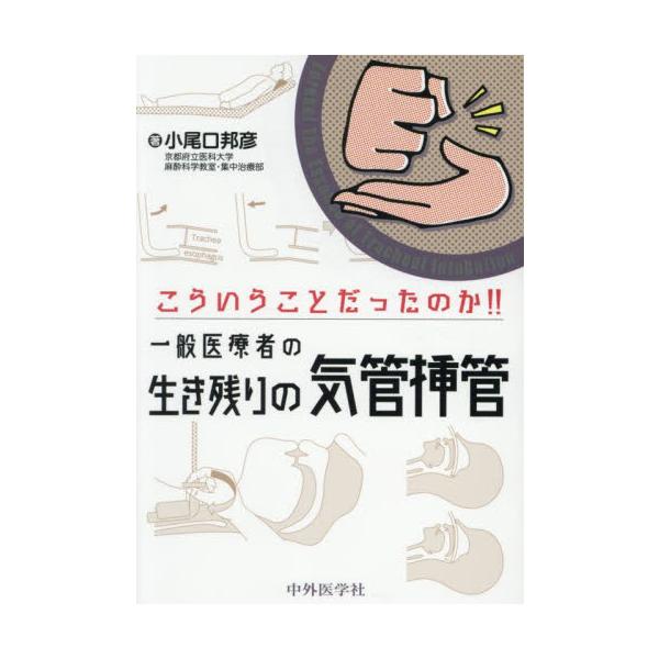 こういうことだったのか！！一般医療者の生き残りの気道挿管 / 小尾口邦彦