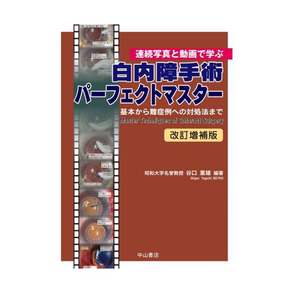 白内障手術パーフェクトマスター 白内障手術パーフェクトマスター 連続写真と動画で学ぶ 基本から難症例
