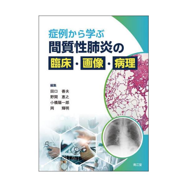 症例から学ぶ間質性肺炎の臨床・画像・病理 / 田口善夫