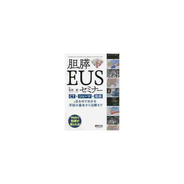 胆膵ＥＵＳセミナー　ＣＴ＋シェーマ＋動画と合わせてわかる手技の基本から治療まで / 肱岡　範　著
