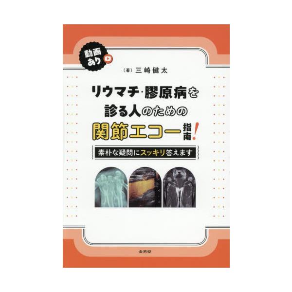 リウマチ・膠原病を診る人のための関節エコー指南！　素朴な疑問にスッキリ答えます / 三崎健太