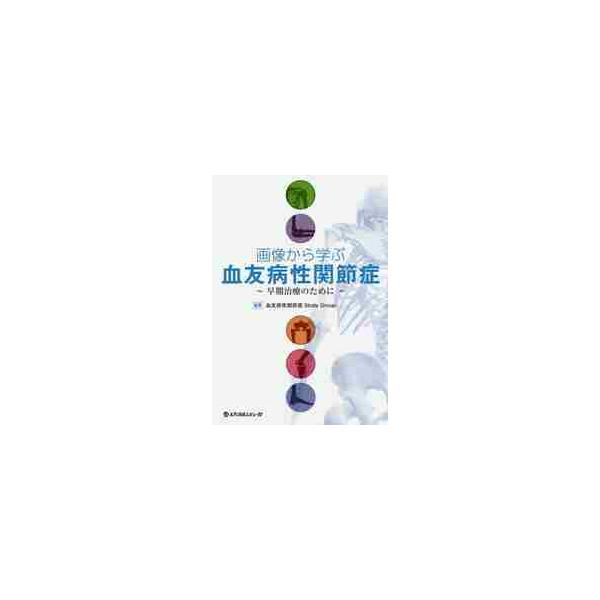 画像から学ぶ血友病性関節症 早期治療のために / 血友病性関節症Ｓｔｕｄｙ Ｇｒｏｕｐ／編集