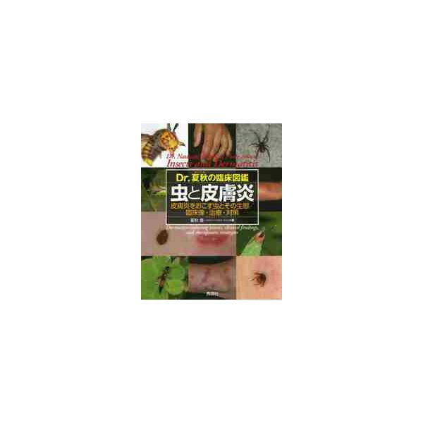 Dr．夏秋の臨床図鑑虫と皮膚炎 皮膚炎をおこす虫とその生態／臨床像