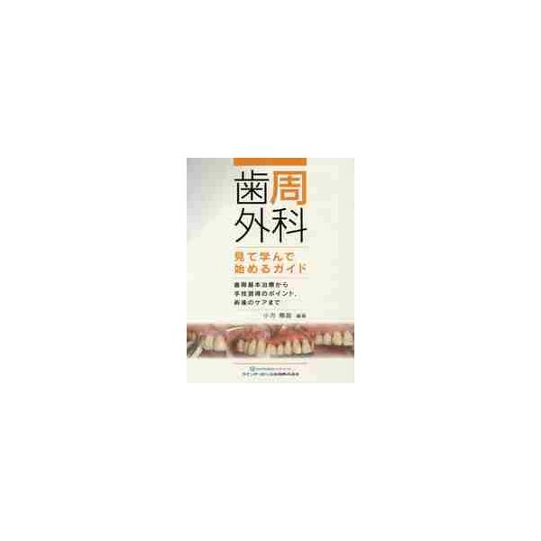 歯周外科見て学んで始めるガイド　歯周基本治療から手技習得のポイント，術後のケアまで / 小方　頼昌　編著